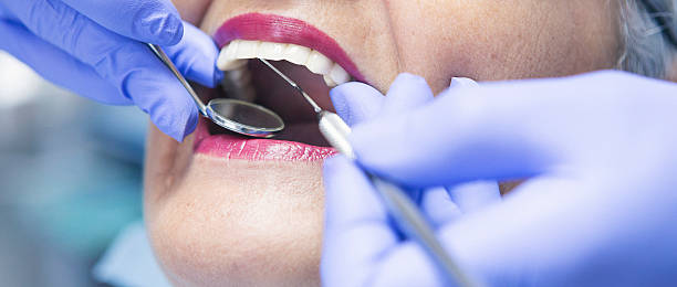 Best Emergency Tooth Extraction in Limestone, IL
